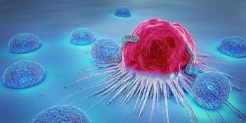 تومور کارسینوما چیست و آیا قابل درمان است؟